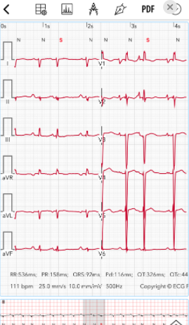 心电图ECG安卓版