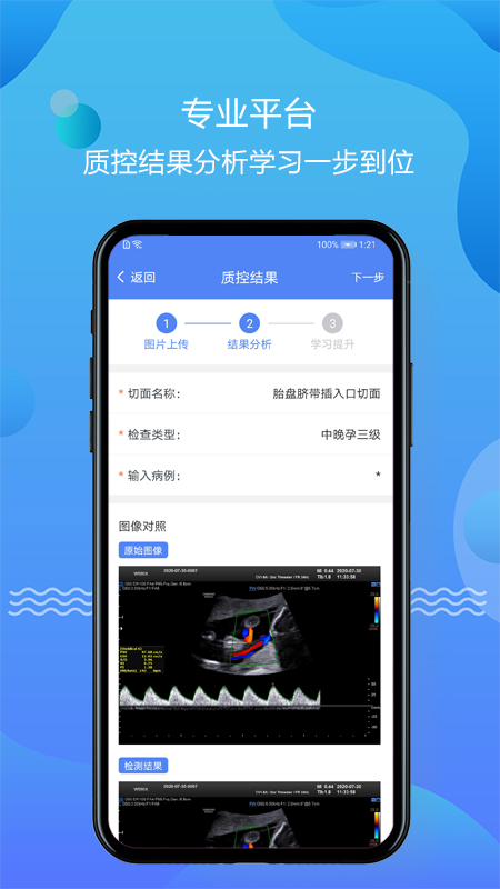 超声智库app截图