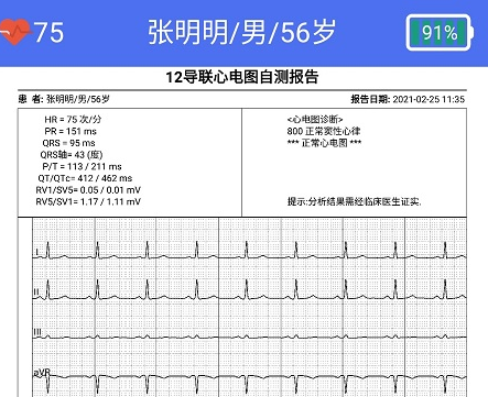 健康2030智能读图心电图系统