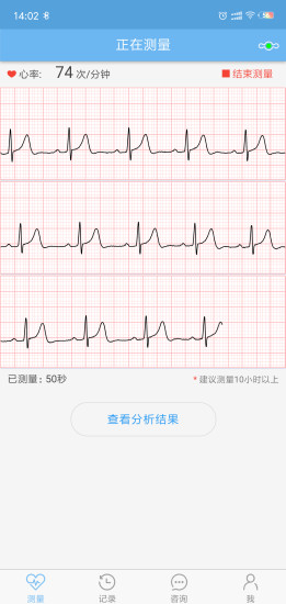 数维康心电app截图